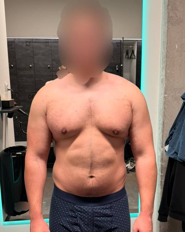 Client before